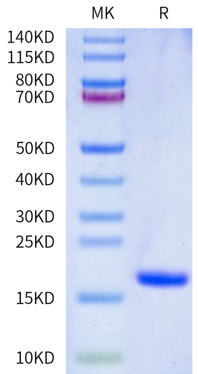 Human IL-36 gamma on Bis-Tris PAGE under reduced condition. The purity is greater than 95%.Recombinant Human IL-36 gamma/IL-1F9 Protein
