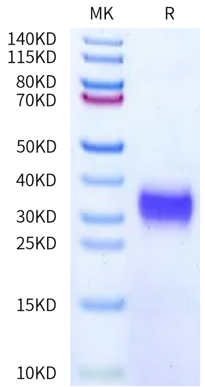 Mouse IL-7 on Bis-Tris PAGE under reduced condition. The purity is greater than 95%.Recombinant Mouse IL-7 Protein, Active