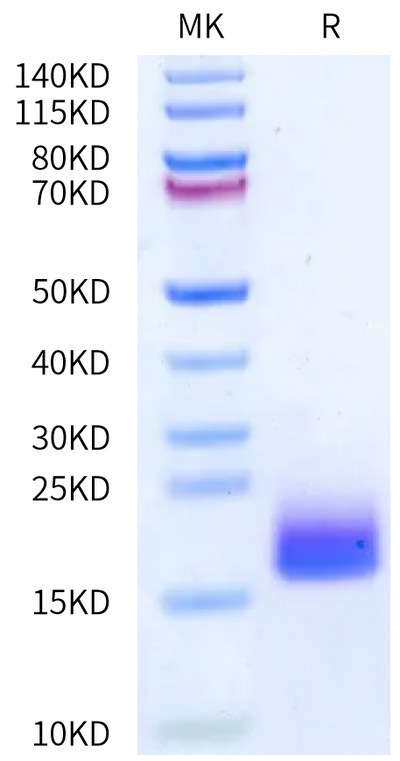 Human LY6G6D on Bis-Tris PAGE under reduced condition. The purity is greater than 95%.Recombinant Human LY6G6D Protein, Active