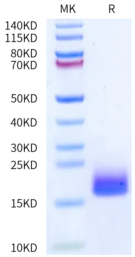 Human LY6G6D on Bis-Tris PAGE under reduced condition. The purity is greater than 95%.Recombinant Human LY6G6D Protein, Active