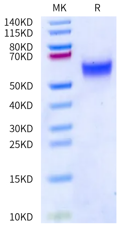 Rat uPAR on Bis-Tris PAGE under reduced condition. The purity is greater than 95%.Recombinant Rat uPAR/PLAUR Protein
