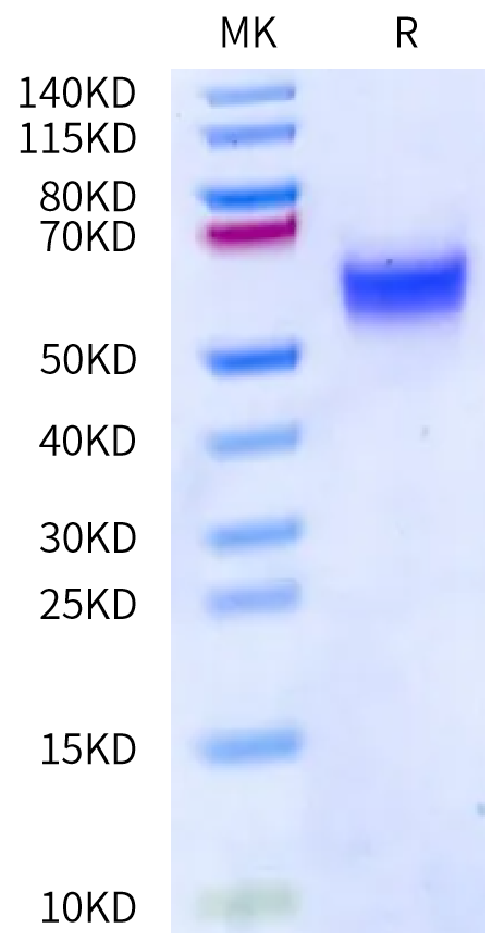 Rat uPAR on Bis-Tris PAGE under reduced condition. The purity is greater than 95%.Recombinant Rat uPAR/PLAUR Protein
