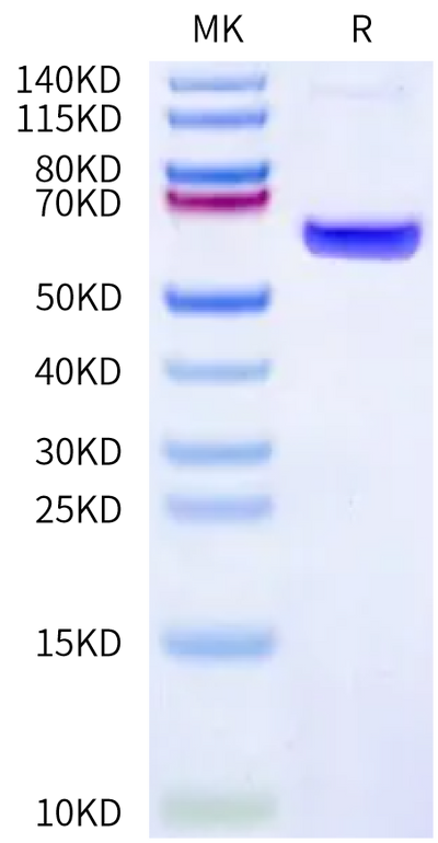 Human CA4 on Bis-Tris PAGE under reduced condition. The purity is greater than 95%.Recombinant Human CA4/Carbonic Anhydrase IV Protein, Active