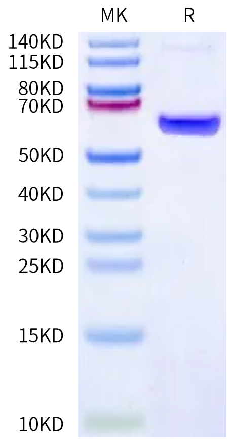 Human CA4 on Bis-Tris PAGE under reduced condition. The purity is greater than 95%.Recombinant Human CA4/Carbonic Anhydrase IV Protein, Active