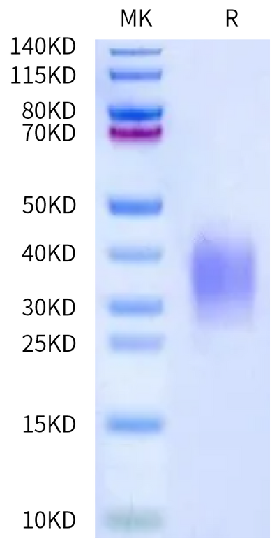 Biotinylated Mouse uPAR Domain 3 on Bis-Tris PAGE under reduced condition. The purity is greater than 95%.Biotinylated Mouse uPAR/PLAUR Domain 3 Protein