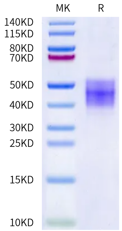 Mouse IL-21R on Bis-Tris PAGE under reduced condition. The purity is greater than 95%.Recombinant Mouse IL-21R Protein, Active