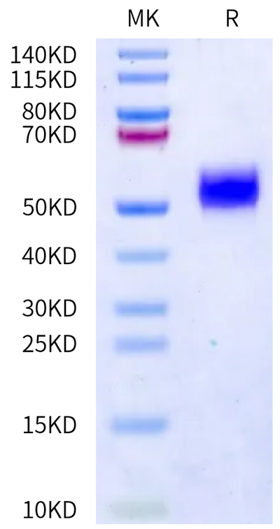Human uPAR on Bis-Tris PAGE under reduced condition. The purity is greater than 95%.Recombinant Human uPAR/PLAUR Protein, Active
