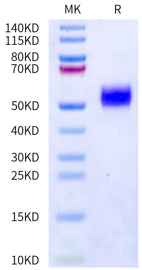 Human uPAR on Bis-Tris PAGE under reduced condition. The purity is greater than 95%.Recombinant Human uPAR/PLAUR Protein, Active