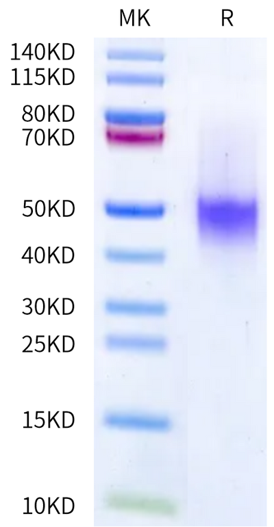 Cynomolgus IL-7 R alpha on Bis-Tris PAGE under reduced condition. The purity is greater than 95%.Recombinant Cynomolgus IL-7 R alpha/CD127 Protein