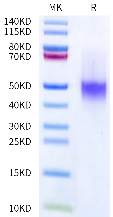 Cynomolgus IL-7 R alpha on Bis-Tris PAGE under reduced condition. The purity is greater than 95%.Recombinant Cynomolgus IL-7 R alpha/CD127 Protein