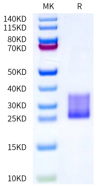 Mouse IL-6 on Bis-Tris PAGE under reduced condition. The purity is greater than 95%.Recombinant Mouse IL-6 Protein