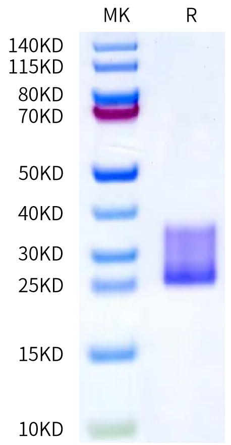 Mouse IL-6 on Bis-Tris PAGE under reduced condition. The purity is greater than 95%.Recombinant Mouse IL-6 Protein