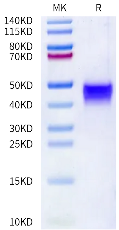 Mouse DKK1 on Bis-Tris PAGE under reduced condition. The purity is greater than 95%.Recombinant Mouse DKK1 Protein, Active