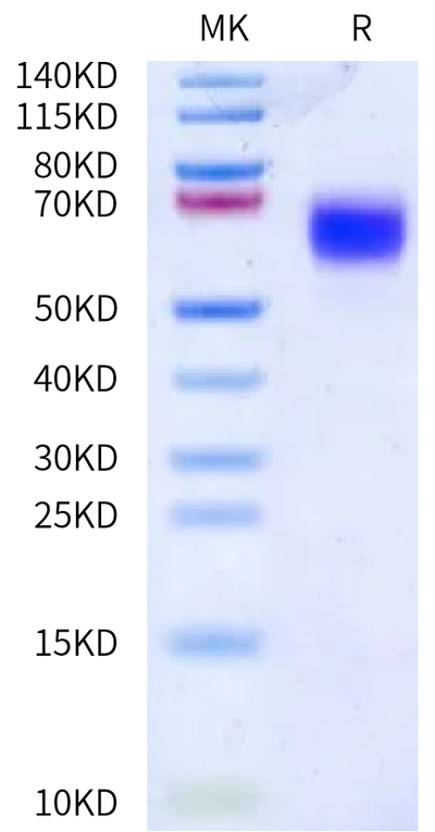 Human IL-1 Rrp2 on Bis-Tris PAGE under reduced condition. The purity is greater than 95%.Recombinant Human IL-1 Rrp2/IL-1 R6 Protein, Active