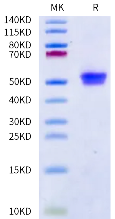Human IgE on Bis-Tris PAGE under reduced condition. The purity is greater than 95%.Recombinant Human IgE Protein, Active