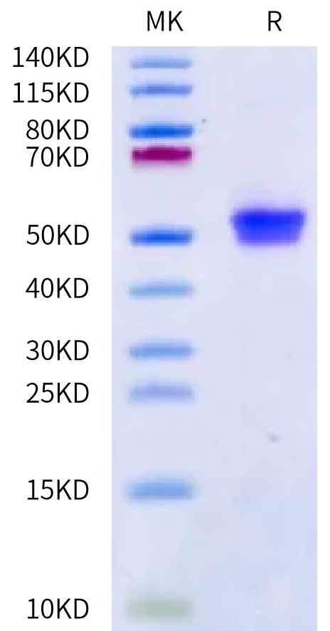 Human IgE on Bis-Tris PAGE under reduced condition. The purity is greater than 95%.Recombinant Human IgE Protein, Active