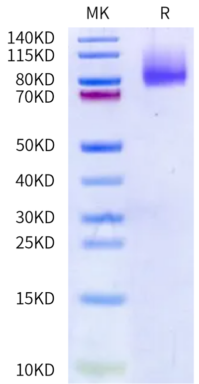 Human Mucin-13 on Bis-Tris PAGE under reduced condition. The purity is greater than 95%.Recombinant Human Mucin-13 Protein, Active