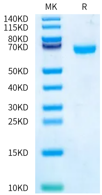 Human CA12 on Bis-Tris PAGE under reduced condition. The purity is greater than 95%.Recombinant Human CA12/Carbonic anhydrase XII Protein