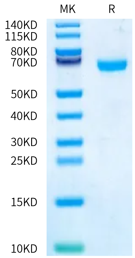 Human CA12 on Bis-Tris PAGE under reduced condition. The purity is greater than 95%.Recombinant Human CA12/Carbonic anhydrase XII Protein
