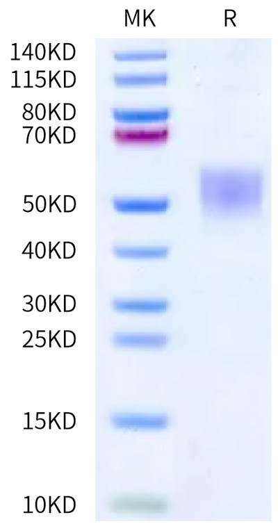 Human UltraPro Mutant CD19 on Bis-Tris PAGE under reduced condition. The purity is greater than 95%.Recombinant Human UltraPro Mutant CD19 Protein, Active