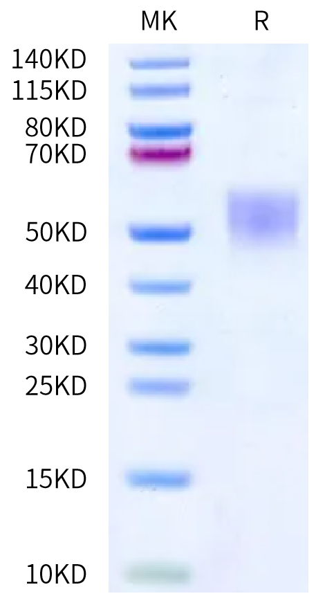 Human UltraPro Mutant CD19 on Bis-Tris PAGE under reduced condition. The purity is greater than 95%.Recombinant Human UltraPro Mutant CD19 Protein, Active