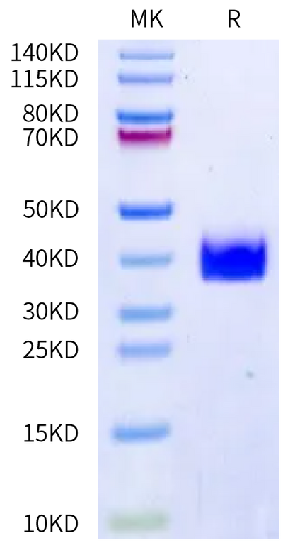 Human DLL3 Domain (216-492) on Bis-Tris PAGE under reduced condition. The purity is greater than 95%.Recombinant Human DLL3 Domain (216-492) Protein, Active