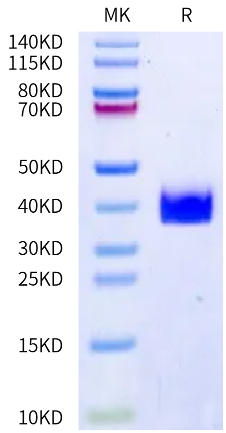 Human DLL3 Domain (216-492) on Bis-Tris PAGE under reduced condition. The purity is greater than 95%.Recombinant Human DLL3 Domain (216-492) Protein, Active