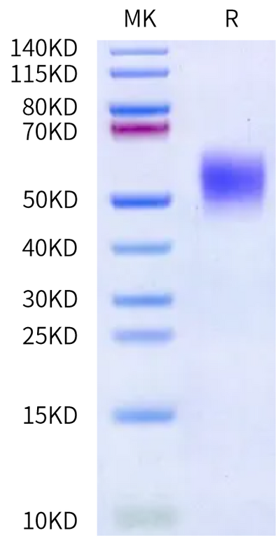 Biotinylated Human IL-4 R alpha on Bis-Tris PAGE under reduced condition. The purity is greater than 95%.Biotinylated Human IL-4 R alpha/CD124 Protein, Active
