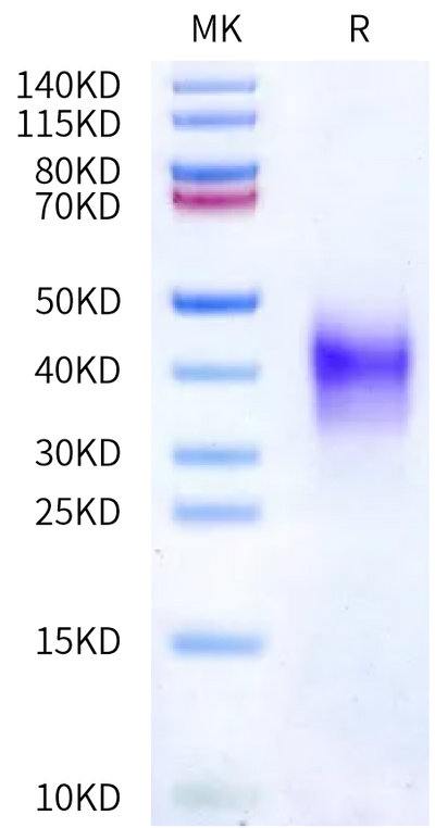 Human CD79B on Bis-Tris PAGE under reduced condition. The purity is greater than 95%.Recombinant Human CD79B Protein, Active