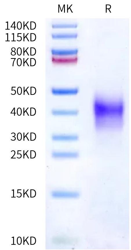 Human CD79B on Bis-Tris PAGE under reduced condition. The purity is greater than 95%.Recombinant Human CD79B Protein, Active