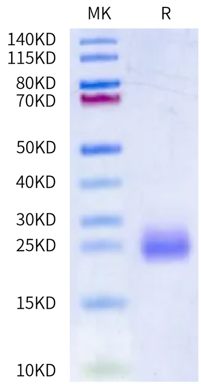 Mouse IL-4 on Bis-Tris PAGE under reduced condition. The purity is greater than 95%.Recombinant Mouse IL-4 Protein