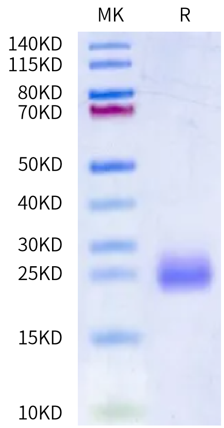 Mouse IL-4 on Bis-Tris PAGE under reduced condition. The purity is greater than 95%.Recombinant Mouse IL-4 Protein