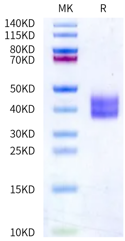 Human Kallikrein 1 on Bis-Tris PAGE under reduced condition. The purity is greater than 95%.Recombinant Human Kallikrein 1/KLK1 Protein, Active