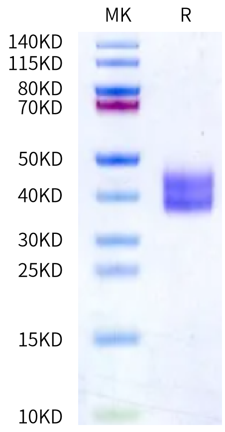 Human Kallikrein 1 on Bis-Tris PAGE under reduced condition. The purity is greater than 95%.Recombinant Human Kallikrein 1/KLK1 Protein, Active