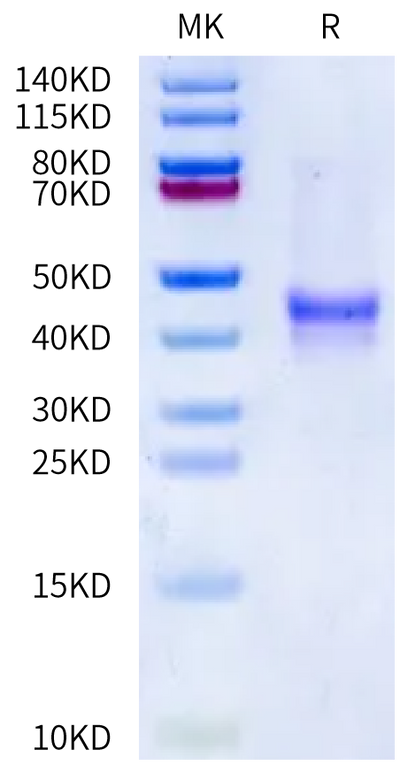 Human Mucin-1 on Bis-Tris PAGE under reduced condition. The purity is greater than 95%.Recombinant Human Mucin-1/MUC-1 Protein
