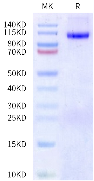 Biotinylated Human DPPIV on Bis-Tris PAGE under reduced condition. The purity is greater than 90%.Biotinylated Human DPPIV/CD26 Protein, Active
