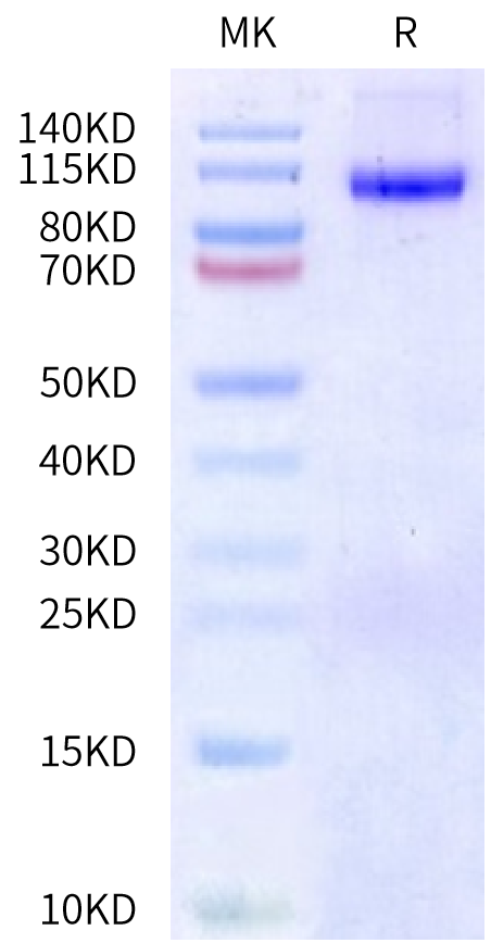 Biotinylated Human DPPIV on Bis-Tris PAGE under reduced condition. The purity is greater than 90%.Biotinylated Human DPPIV/CD26 Protein, Active