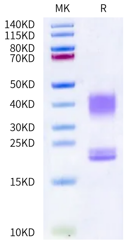Cynomolgus CD3E&CD3D on Bis-Tris PAGE under reduced condition. The purity is greater than 95%.Recombinant Cynomolgus CD3E&CD3D/CD3 epsilon&CD3 delta Protein, Active