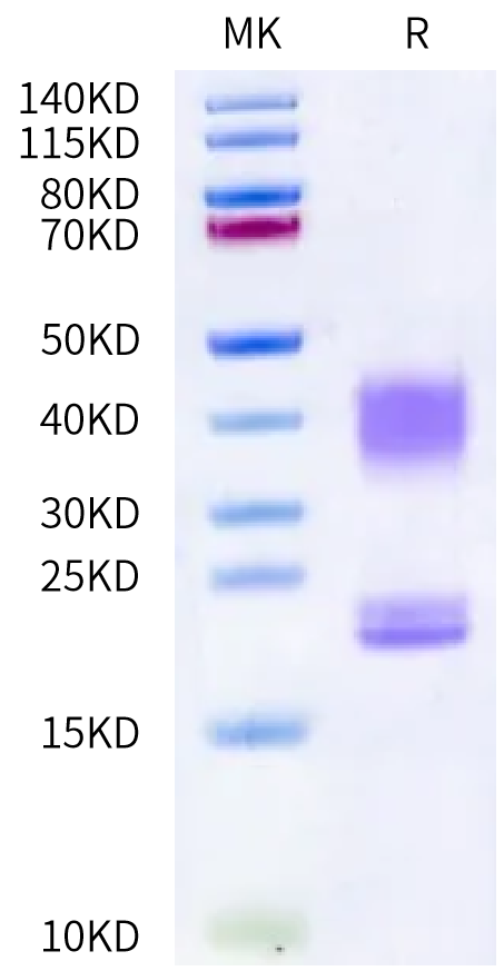 Cynomolgus CD3E&CD3D on Bis-Tris PAGE under reduced condition. The purity is greater than 95%.Recombinant Cynomolgus CD3E&CD3D/CD3 epsilon&CD3 delta Protein, Active