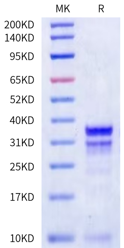 Mouse Kallikrein 7 on Bis-Tris PAGE under reduced condition. The purity is greater than 90%.Recombinant Mouse Kallikrein 7/KLK7 Protein, Active