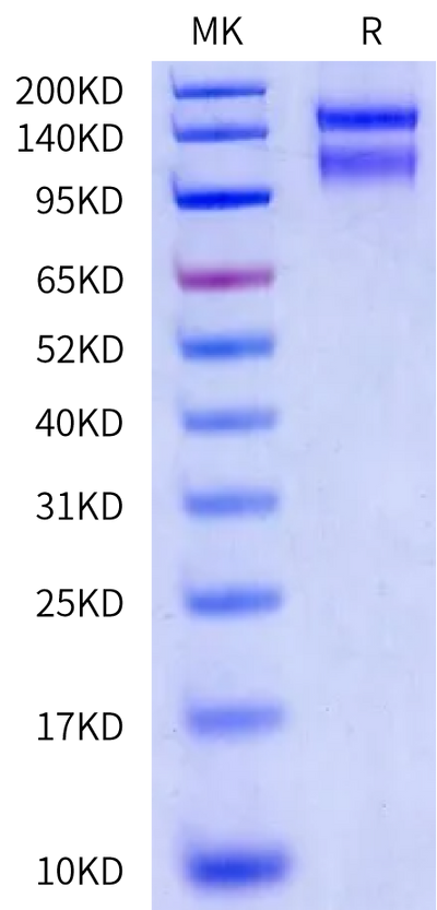 Biotinylated Human ITGA2&ITGB1 on Bis-Tris PAGE under reduced condition. The purity is greater than 95%.Biotinylated Human Integrin alpha 2 beta 1 (ITGA2&ITGB1) Heterodimer Protein