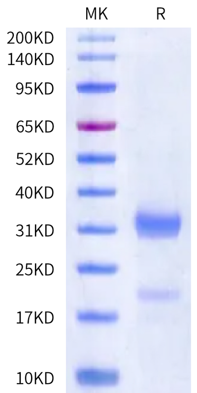 Human Kallikrein 2 on Bis-Tris PAGE under reduced condition. The purity is greater than 90%.Recombinant Human Kallikrein 2/KLK2 Protein, Active