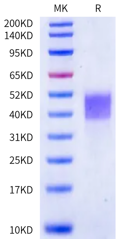 Cynomolgus Kallikrein 5 on Bis-Tris PAGE under reduced condition. The purity is greater than 95%.Recombinant Cynomolgus Kallikrein 5/KLK5 Protein, Active