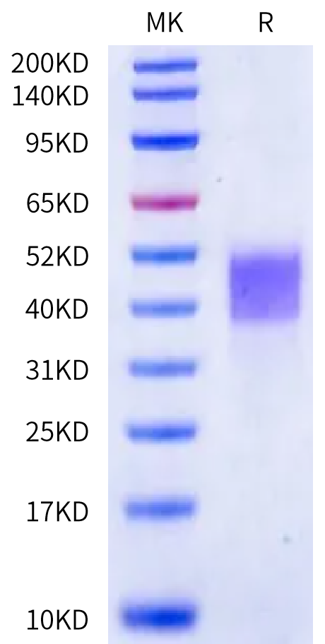 Cynomolgus Kallikrein 5 on Bis-Tris PAGE under reduced condition. The purity is greater than 95%.Recombinant Cynomolgus Kallikrein 5/KLK5 Protein, Active
