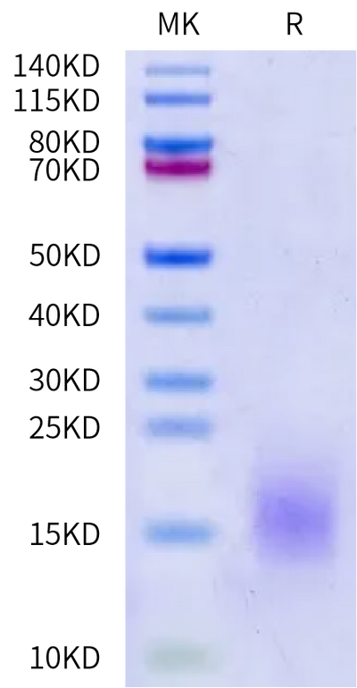 Human BCMA on Bis-Tris PAGE under reduced condition. The purity is greater than 95%.Recombinant Human BCMA/TNFRSF17 Protein, Active