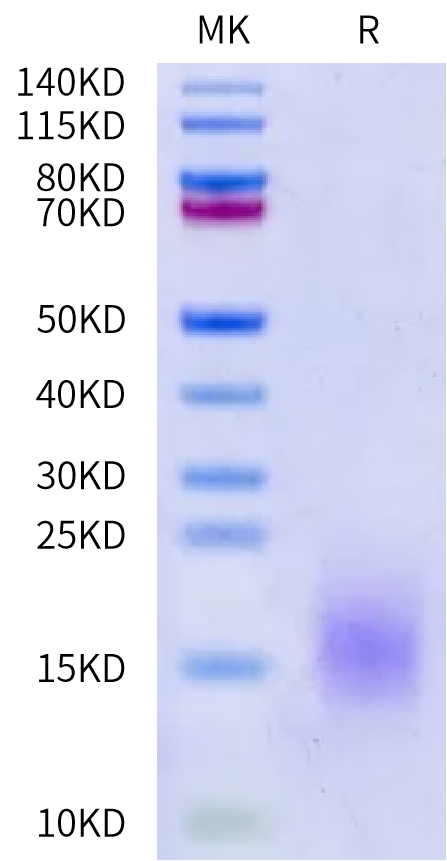 Human BCMA on Bis-Tris PAGE under reduced condition. The purity is greater than 95%.Recombinant Human BCMA/TNFRSF17 Protein, Active