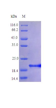 SDS-PAGE of Recombinant Human Interleukin-6 protein (IL6)