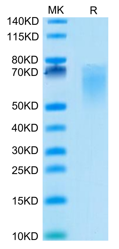 Cynomolgus B7-2 on Tris-Bis PAGE under reduced condition. The purity is greater than 95%.Recombinant Cynomolgus B7-2/CD86 Protein, Active