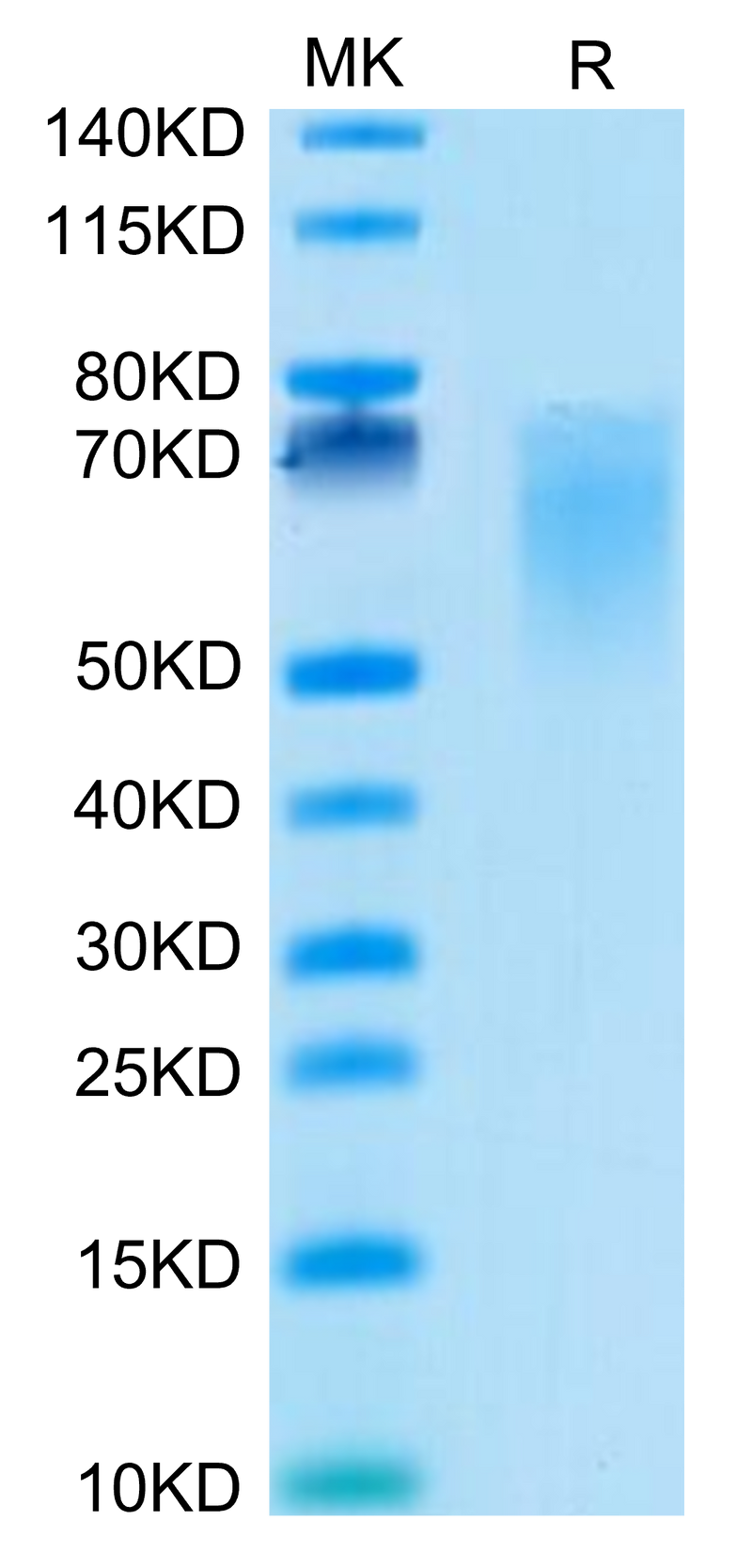 Cynomolgus B7-2 on Tris-Bis PAGE under reduced condition. The purity is greater than 95%.Recombinant Cynomolgus B7-2/CD86 Protein, Active