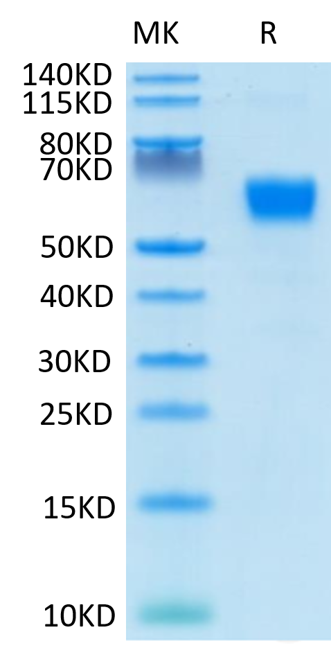 Human/Cynomolgus/Rhesus macaque CD28 on Tris-Bis PAGE under reduced condition. The purity is greater than 95%.Recombinant Human/Cynomolgus/Rhesus macaque CD28 Protein, Active